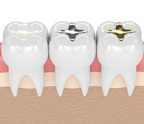 Treatment - Citident Dental Practice