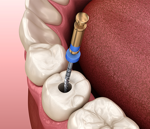 Treatment - Citident Dental Practice